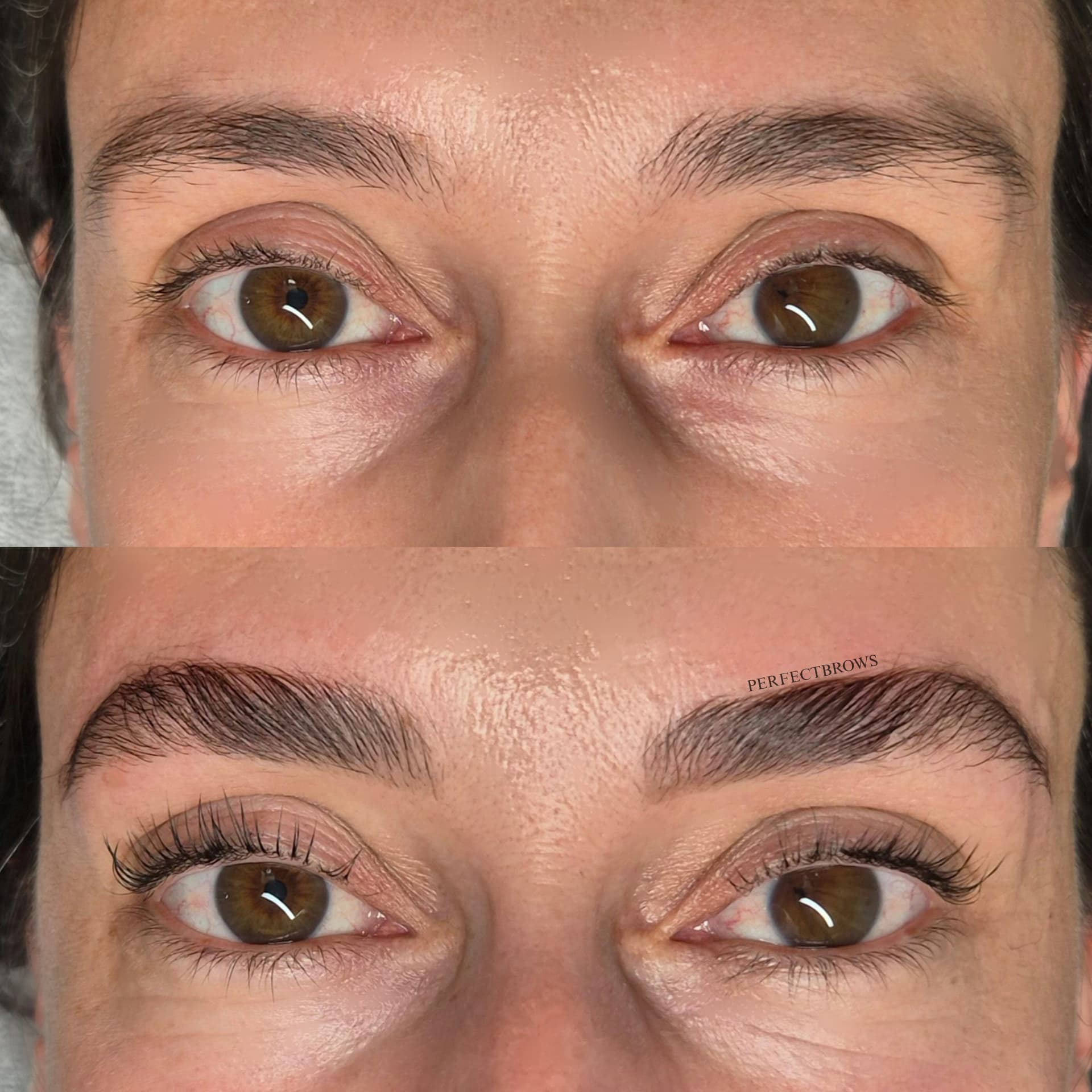 BrowLifting Ergebnis 4