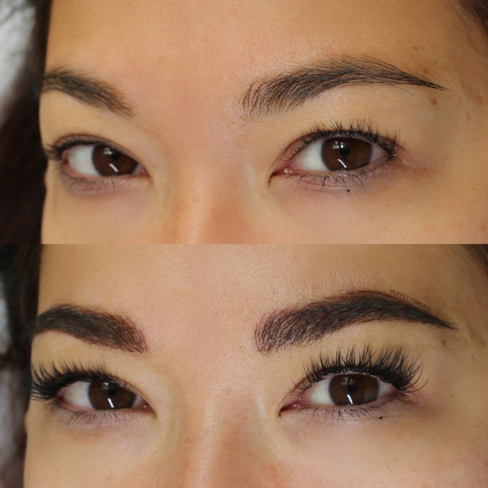 BrowLifting Ergebnis 3