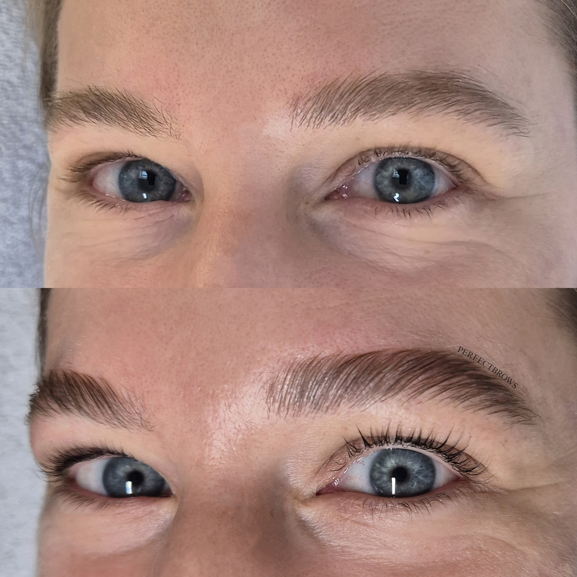 BrowLifting Ergebnis 2