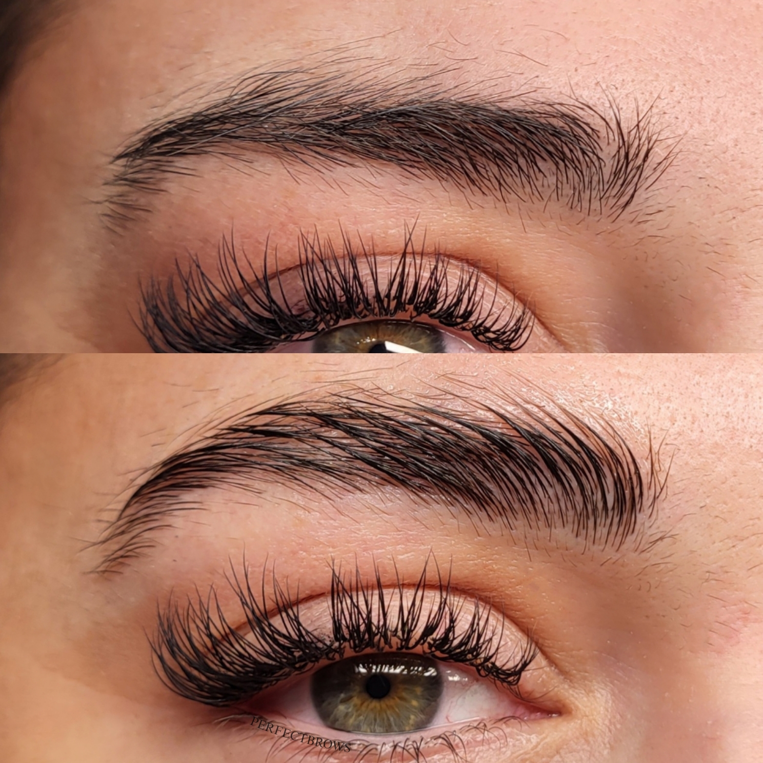 BrowLifting Ergebnis 1